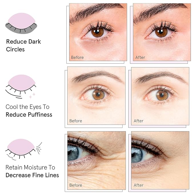 grace & stella Under Eye Mask Variety Pack - 18 Pairs of Under Eye Patches for Dark Circles - With 6 Colors (3 Pairs/Color) - Gel Masks Puffy Eyes for Women, Vegan Cruelty Free Christmas Gifts for Mom